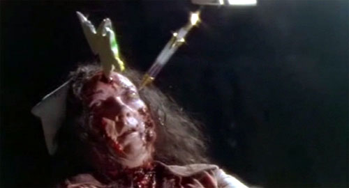 BRAIN DEAD