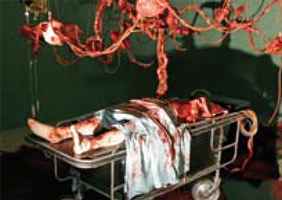 Autopsy